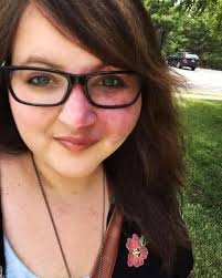 Stranger's kindness about birthmark