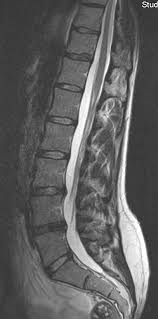Wie kommt man in die röhre bei einer mrt an der lws? Mrt Magnetresonanztomographie Radiologie Neuroradiologie Berlin Mitte Dr Korves Smartphone Tauglich