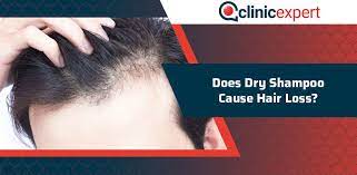Dry scalp is a mild condition and one of the balding signsthat should even lead to hair loss. Does Dry Shampoo Cause Hair Loss Clinicexpert International Hair Transplant Plastic Surgery