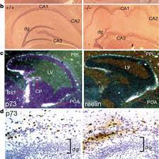 By clevers, hans c, oosterwegel, mariëtte a, georgopoulos, katia published in immunology today (1993. Mariette A Oosterwegel S Research Works University Medical Center Utrecht Utrecht Umc Utrecht And Other Places