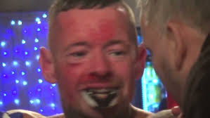 Tank Promotions Friday Fight Night Bout 15 Harry Dudley Vs Cyrus Mcintyre