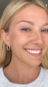 TOX journey timeline., 💉, Day 1–2:, Nothing noticeable yet. A slight  “tight” feeling is normal., •, Day 3–4:, Subtle softening begins. Movement  is still present., •, Day 5–7:, Visible smoothing. Most ...