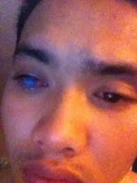 Fundraiser by Jerson Jardiel : Kyle's Fight Against Blindness