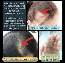 Tidak akan mengasari rambut tetapi berfungsi untuk merawat rambut daripada sakit dan luka punca masalah kelemumur dan kegatalan kulit kepala. Tips Efektif Elak Rambut Gugur Dan Botak Posts Facebook