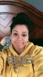 Can Braces Cause Dimples? Exploring Adult Braces Trend