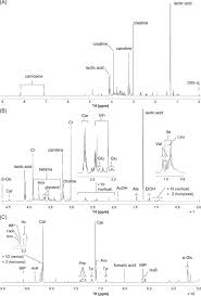 We did not find results for: Nmr Based Metabolomics For Simultaneously Evaluating Multiple Determinants Of Primary Beef Quality In Japanese Black Cattle Scientific Reports