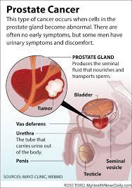 Colon cancer is the third deadliest cancer affecting both men and women in the united states. 14 Best Sharing Public Health Knowledge Ideas Health Health Knowledge Ovarian