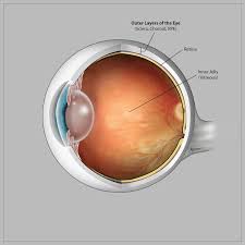 If your retina gets torn, the fluid inside your eye can leak underneath and. Retinal Detachment Medical Opticsmedical Optics