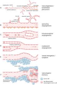 Image result for Angiogenesis