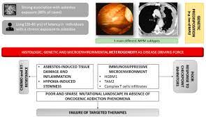Biopsy, a procedure to remove a small portion of tissue for laboratory examination, is the only way to determine whether you have mesothelioma. Cancers Free Full Text Malignant Pleural Mesothelioma Genetic And Microenviromental Heterogeneity As An Unexpected Reading Frame And Therapeutic Challenge Html