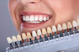Find everything to fuel your health at biovea How Long Teeth Whitening Takes