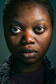 Drug & Alcohol Stigma Campaign — Sarah Lauder Production