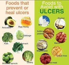 Some Strategies How To Manage Ulcer