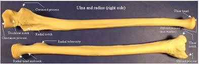 Labelled radius bone radius along with ulna connects elbow to forearm. Skeletal Series Part 7 The Human Arm These Bones Of Mine