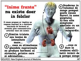 Nu stiu ce sa fac. Dureri Inzona Inimii Wasatchpremiermovers Com