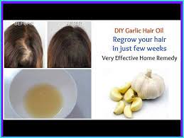 Garlic For Hair Growth How It Works Healthy Allergy Free Garlic For Hair Growth Super Hair Growth Hair Oil