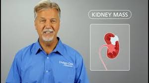 In other cases, the cause of a symptom may be a different medical condition that is not cancer. Kidney Cancer Symptoms Diagnosis Treatment Urology Care Foundation