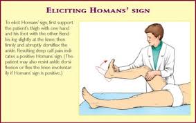 A Fun And Easy Way To Remember Homan S Sign In Medicine Healthcare Homans Sign Nursing Information Nursing Students