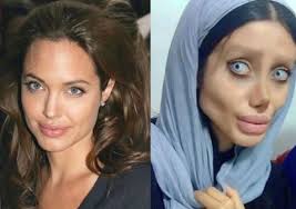 Plastic surgeries are becoming more and more common throughout the country. Plastic Surgery Gone Wrong Woman 19 Underwent 50 Surgeries To Look Like Angelina Jolie Tuko Co Ke