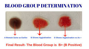 Blood Group Test Different Types Of Blood Group By Solution Pharmacy
