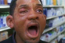 Don T Be Like Alex Hitchens Will Smith And Find Out Late That You Have A Food Allergy Contact Dr Andrew Lozano Today To Allergies Quote Hitched Hitch Movie