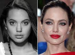 The actress has never confirmed that she's gotten a nose job, but multiple plastic surgeons have said that it looks like she's had a rhinoplasty . Angelina Jolie Before And After The Skincare Edit