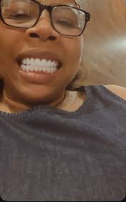 Okay No filter …. Dr Sebastian Cali Colombia $4800 5days Flight not  included I got 2 bridges All are EMax Porcelain  https://www.instagram.com/drsebastianmanzano?igsh=MzRlODBiNWFlZA==