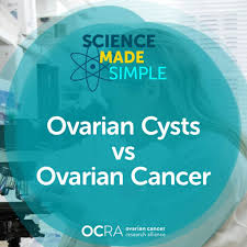 I didn't just have cysts. Difference Between Ovarian Cyst And Ovarian Cancer Ocra