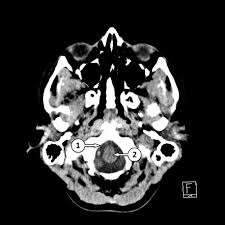 Image result for CT Head