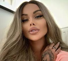 28-latka zmarła podczas operacji w Turcji. Poddała się popularnemu wśród  celebrytów zabiegowi