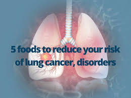 Lung cancer is one of the most common forms of cancer, with more than 2,000,000 people diagnosed worldwide each year, and is the leading cause of cancer death globally. World Lung Cancer Day 5 Foods To Reduce Your Risk Of Lung Disorders And Cancer Health Tips And News