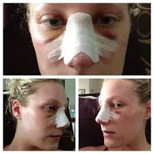 Brian Hass, MD, Board Certified Plastic Surgeon