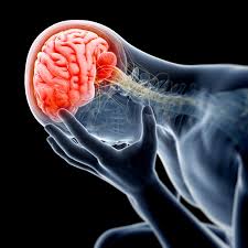 A migraine is an intense headache that can last for hours. Is Your Morning Headache A Sign Of A Brain Tumor