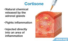 Image result for Cortisone