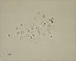 Pin By Marie O Dell On Urine Medical Laboratory Medical Laboratory Scientist Urinal