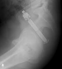 Pin On Rx