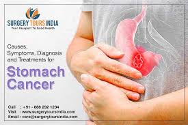 The common signs of stomach cancer that a patient experiences include: Guide To Understand Stomach Cancer Causes Symptoms And Treatment
