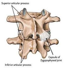 Learn how a facet joint injection delivers steroid medication which anesthetizes the joints and blocks the pain. Facet Disease Facet Syndrome Complete Spine And Pain Care