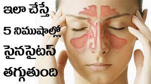 Cure Your Sinuses In 5 Minutes With At Home Remedies Telugu Mirchi Youtube