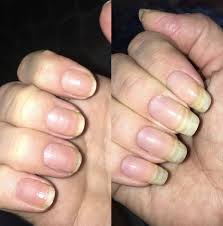 17 nail strengtheners for dry, brittle, or weak nails. Over 2 000 People Swear By This Strengthener To Grow Naturally Long Nails