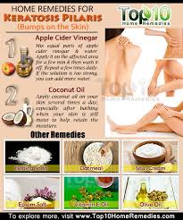 Home Remedies For Keratosis Pilaris Bumps On The Skin Top 10 Home Remedies Keratosis Pilaris Skin Remedies Skin Disorders