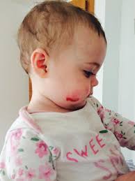 eloise sutton-kirkby is fundraising for DEBRA