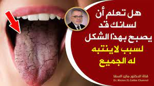 دكتور مازن السقا march 29 · أحد أهم أسرار تنظيف البشرة وتفتيح وتقشير الوجه والتخلص من التجاعيد والكلف والتصبغات والبقع البنية Ø®Ø·Ø±Ù‚Ø¯ ÙŠØ¯Ø§Ù‡Ù…Ùƒ ÙØ¬Ø£Ø© ÙŠØ®Ø±Ø¨ Ø§Ù„Ø¬Ø³Ù… ÙˆÙŠØ³Ø¨Ø¨ Ø§Ù„Ø§Ù„ØªÙ‡Ø§Ø¨Ø§Øª ÙˆØ§Ù„ØªÙ‚Ø±Ø­Ø§Øª Ù‡Ø°Ù‡ Ø£ÙØ¶Ù„ Ø·Ø±Ù‚ Ø§Ù„ÙˆÙ‚Ø§ÙŠØ© ÙˆØ§Ù„Ø¹Ù„Ø§Ø¬ Ù…Ù† Ø§Ù„ÙØ·Ø±ÙŠØ§Øª Youtube