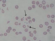 Schizocit Wikipedia