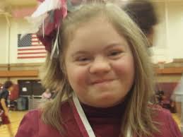 Down Syndrome Archives