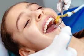 都是洗牙爲啥他花三百你花了三千in 2020 health children