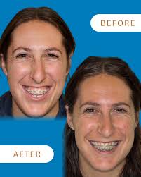 You don't usually expect to find a garden at an oral surgery office…but  that's exactly what makes Bluebird special 🌱✨ We designed our space to  feel peaceful and inviting—because your care experience