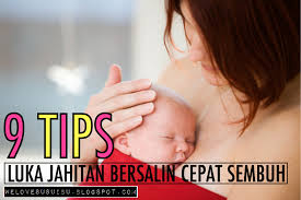 Biasanya luka jahitan bersalin akan sembuh dalam tempoh dua hingga empat minggu. 9 Tips Luka Jahitan Bersalin Terbaik Supaya Luka Cepat Baik Tak Bernanah Hadiah Terindah Dari Ibu Untuk Anaknya