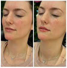 Cast Your Vote for the Top 100 Best Aesthetic Injectors in the USA 2026