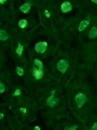 Image result for ANA Staining Pattern